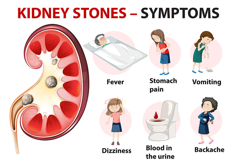 Renal Kidney Stone Treatment in Pune