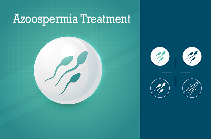 Azoospermia Treatment in Pune