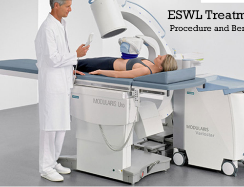 Procedure and Benefits of ESWL