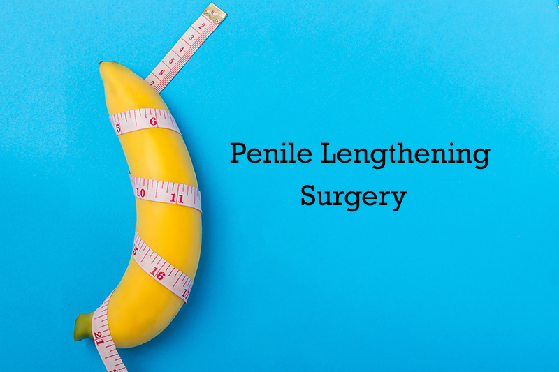 Urology & Andrology Blog By Dr. Irfan Shaikh Urolife Clinic, Pune