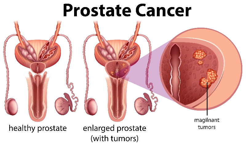 What does the Prostate do for a Man?