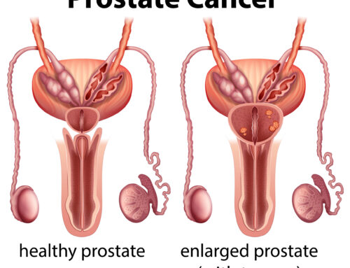 प्रोस्टेट कैंसर (Prostate Cancer) – प्रोस्टेट कैंसर क्यों होता है, लक्षण, उपचार, दवा