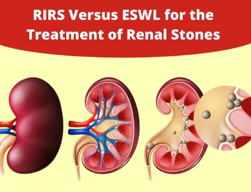RIRS Versus ESWL for the Treatment of Renal Stones