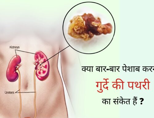 क्या बार-बार पेशाब करना किडनी स्टोन का संकेत हैं?(Is frequent urination a sign of kidney stone in Hindi)