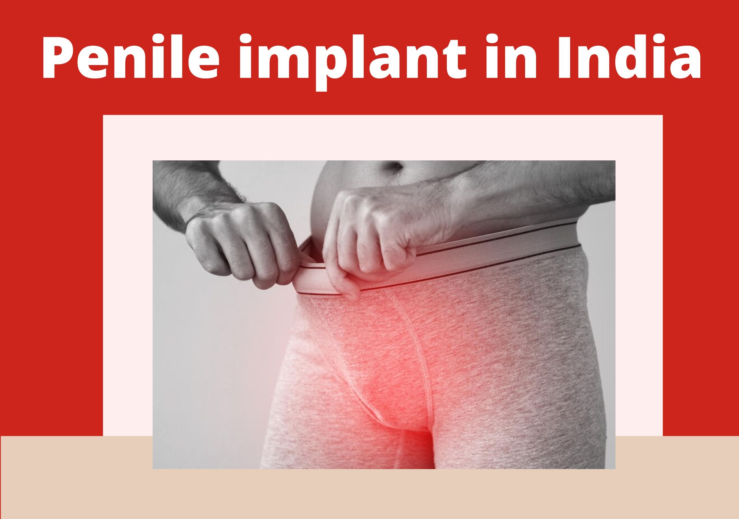 Penile implant Surgery in Pune