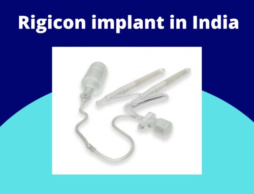 Rigicon implant in India