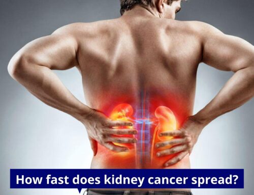 How fast does kidney cancer spread?