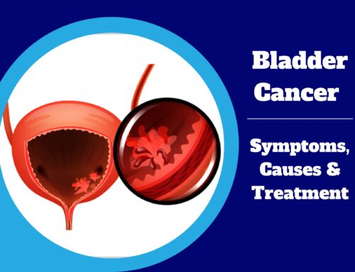 Bladder Cancer: Symptoms, Causes & Treatment