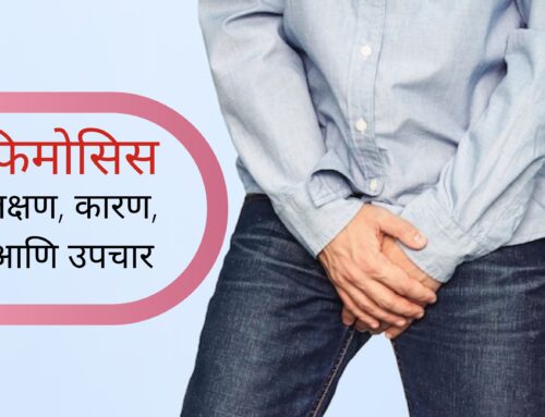 फिमोसिस (phimosis) ची  लक्षण, कारण, आणि उपचार ( Symptoms, causes, and treatment of phimosis in Marathi)