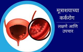 मूत्राशयाच्या कर्करोग | Bladder Cancer Treatment in Pune | Urolife Clinic