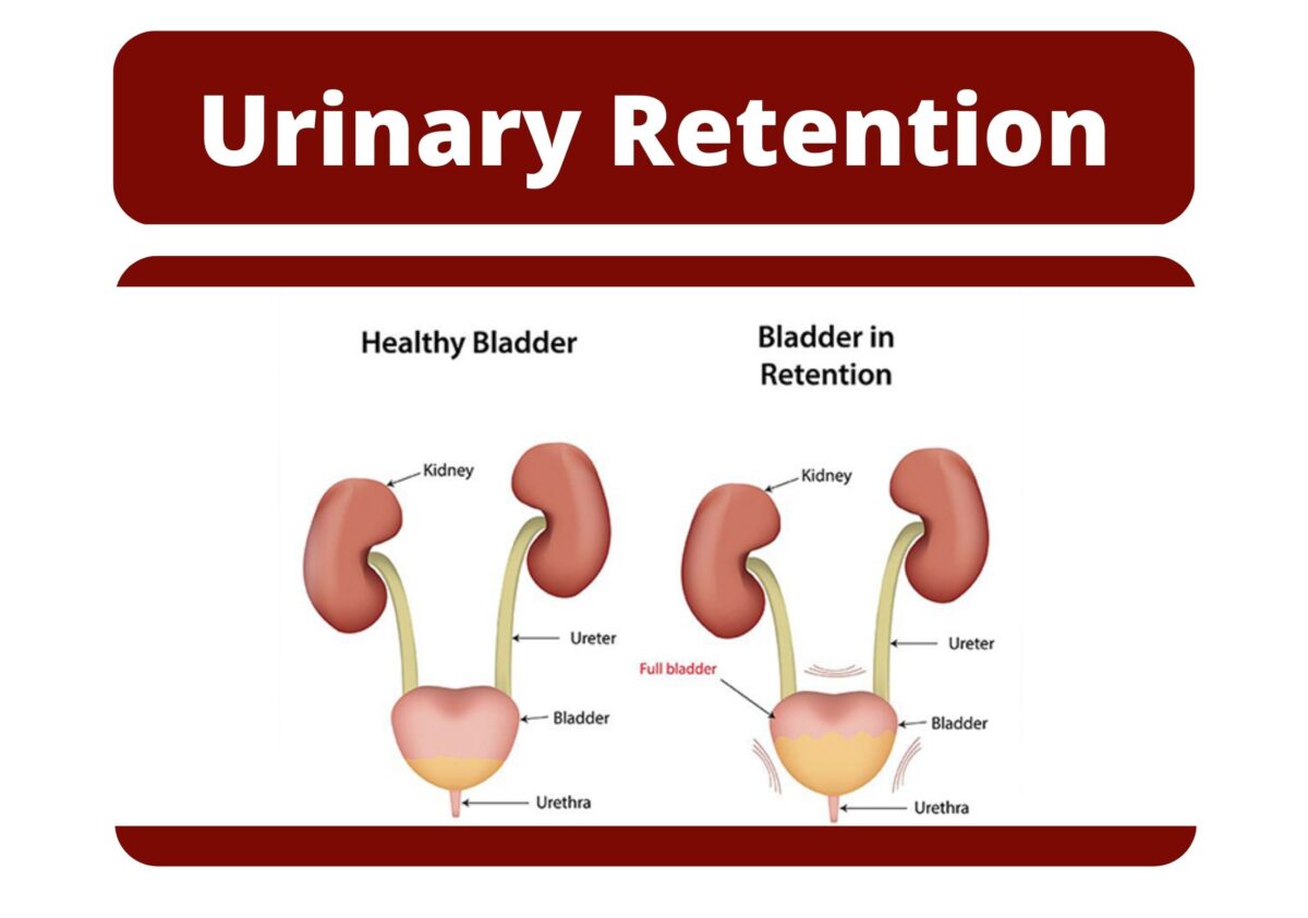 which cues support the hypothesis of urinary retention