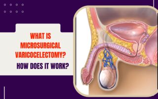 Microsurgical Varicocelectomy | Urolife Clinic