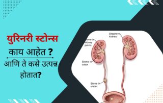 युरिनरी स्टोन्स | Urinary Stones Treatment in Pune | Urolife Clinic