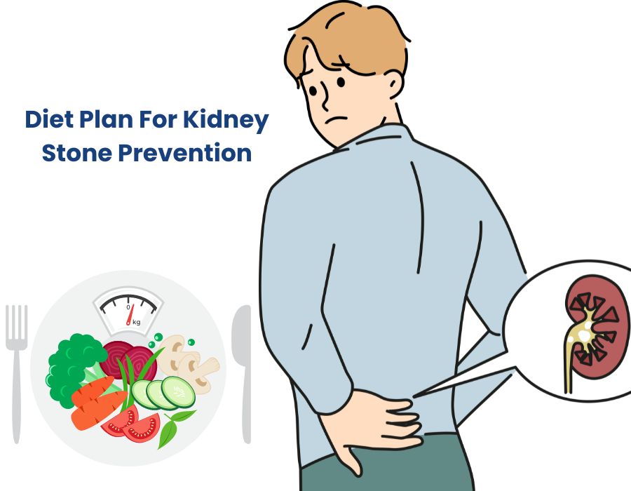 Diet Plan For Kidney Stone Prevention | Dr. Irfan Shaikh
