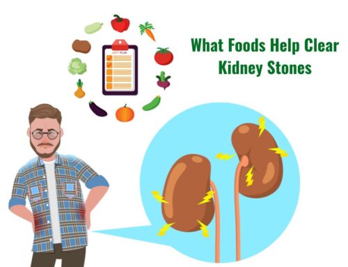 Foods That Aid in Clearing Kidney Stones